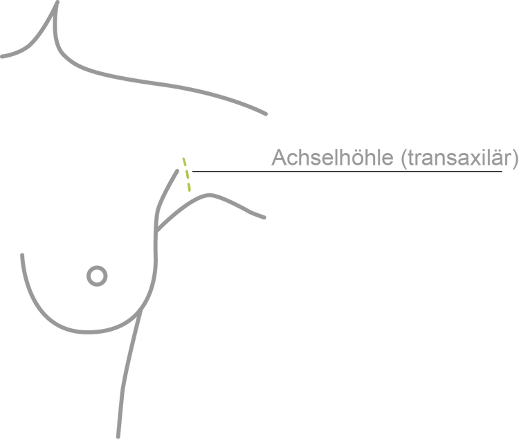 Achselschnitt | axillär